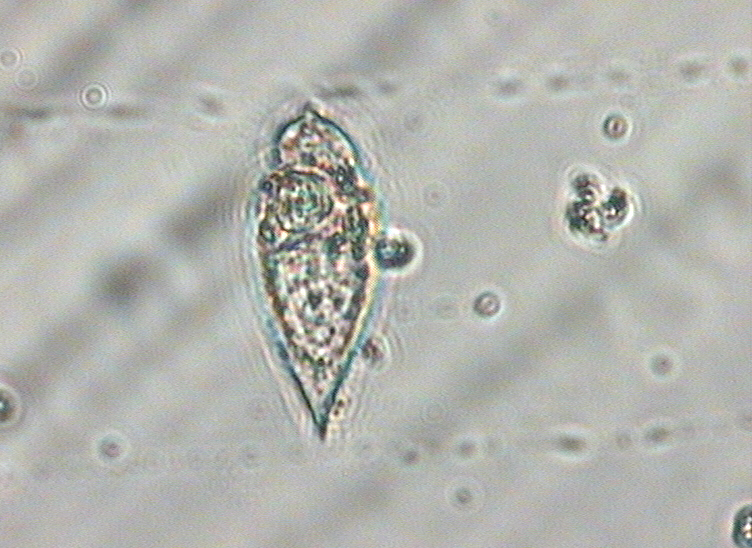 Dictyocha speculum